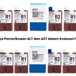 ALT dan AST: Enzim Kunci dalam Pemeriksaan Fungsi Hati